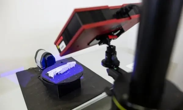 3D-Scanner